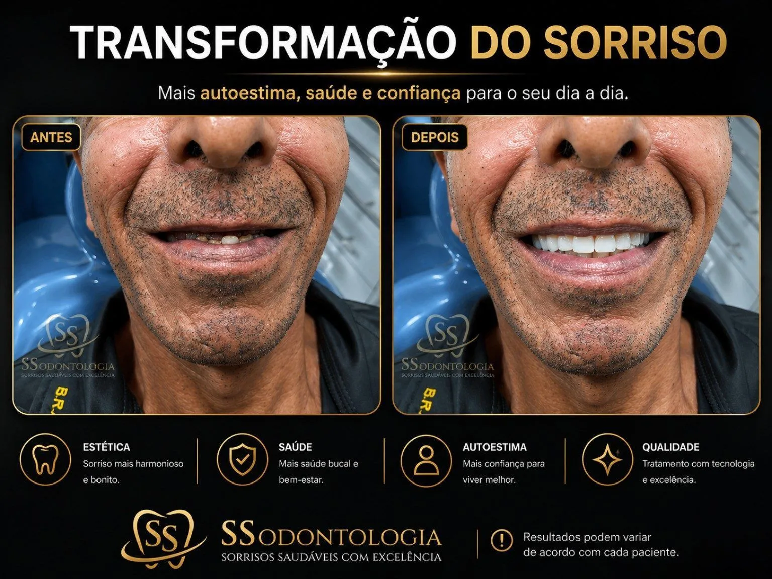 Antes e depois: Reabilitação Oral